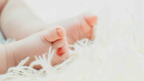 Hemanjiyom prematüre bebeklerde daha sık görülüyor