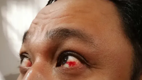 Diyabetik retinopati hastalığında erken tanı önemli