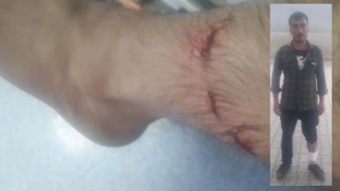 Başıboş köpeklerin saldırısına uğradı